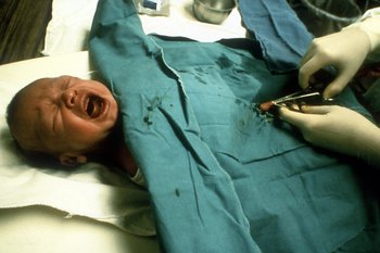 Circumcision trauma