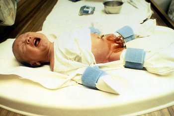 Circumcision trauma